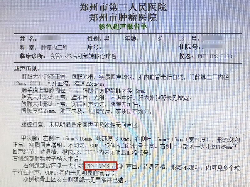 关注前沿-每个碘125粒子都像一颗小太阳,不断向肿瘤发出γ射线