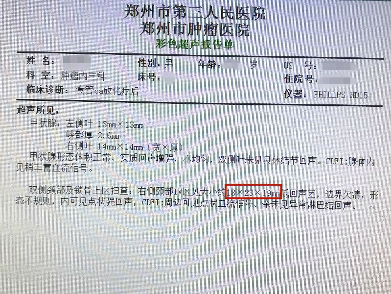 关注前沿-每个碘125粒子都像一颗小太阳,不断向肿瘤发出γ射线
